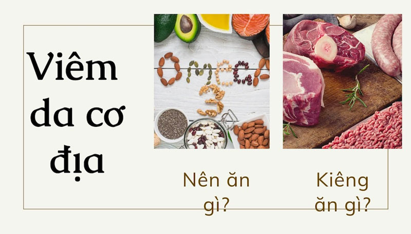 Bệnh viêm da cơ địa kiêng ăn gì?