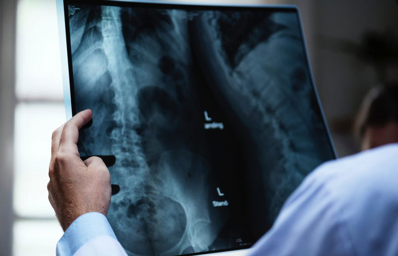 Bác sĩ thường chỉ định bệnh nhân đi chụp X-quang