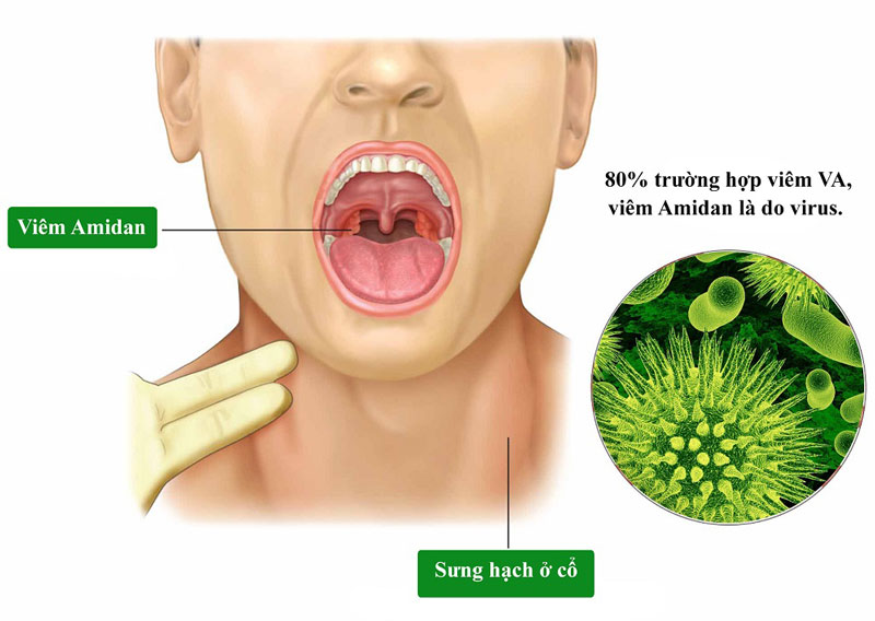 cắt amidan có đau không