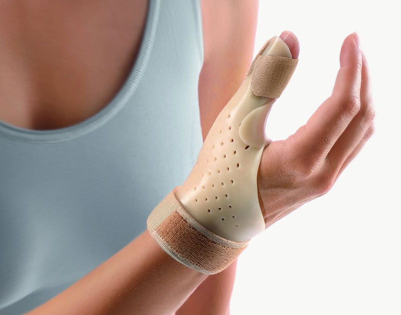 Nhiều bệnh nhân được chỉ định cố định cổ tay, ngón tay cái
