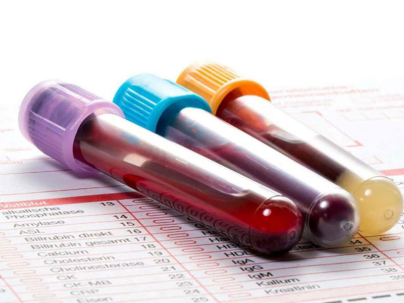 Xét nghiệm máu dùng để chẩn đoán mụn rộp sinh dục