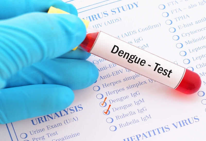 Nên xét nghiệm kháng nguyên Dengue NS1 từ ngày thứ 1 đến ngày thứ 3 tính từ khi có dấu hiệu bệnh