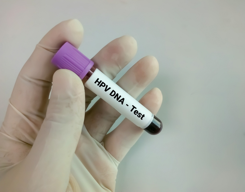 Xét nghiệm virus HPV để chẩn đoán bệnh sùi mào gà