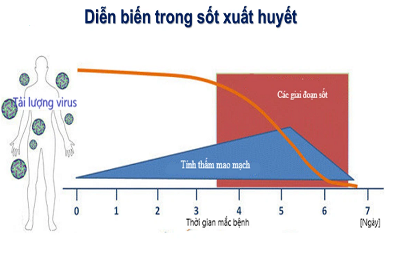 Sốt xuất huyết có thể bất ngờ chuyển biến nặng