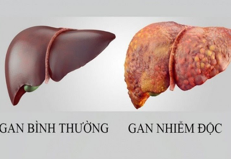 Thực phẩm hỗ trợ thải độc gan