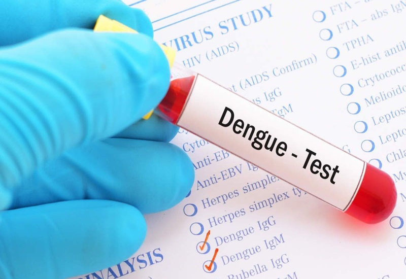 Xét nghiệm kháng nguyên Dengue NS1 để xác định bệnh