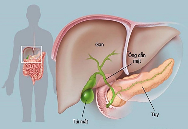 Ung thư đường mật thường được phát hiện ở giai đoạn muộn