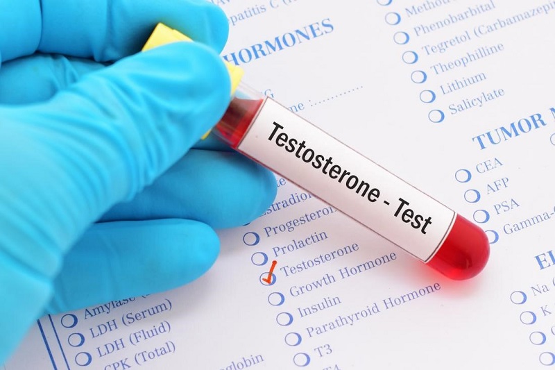 Testosterone là xét nghiệm không thể thiếu khi khám nội tiết