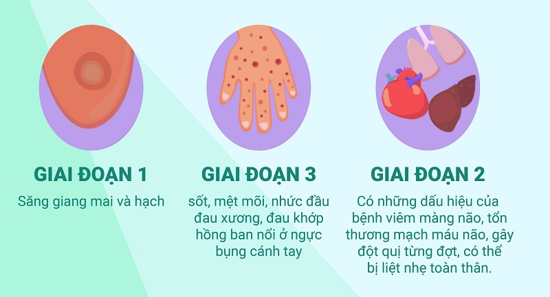 Dấu hiệu bệnh giang mai theo giai đoạn