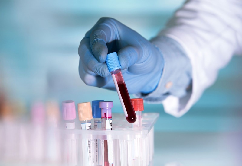 Lấy máu xét nghiệm dị nguyên Panel là phương pháp mang nhiều ưu điểm vượt trội