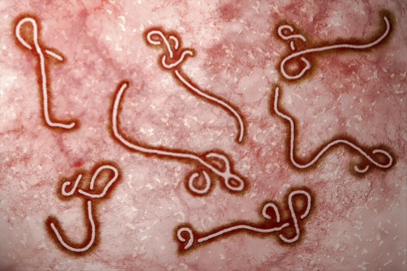 Bệnh Ebola: triệu chứng và cách phòng ngừa hiệu quả – Medlatec.vn
