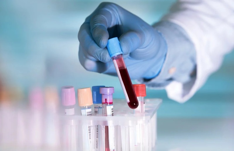 Xét nghiệm nhóm máu giúp bạn nắm được thông tin về nhóm máu của mình