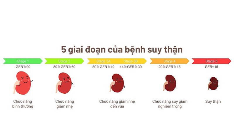 Suy thận gồm 5 cấp độ, cấp độ 2 là giai đoạn đầu của bệnh lý này