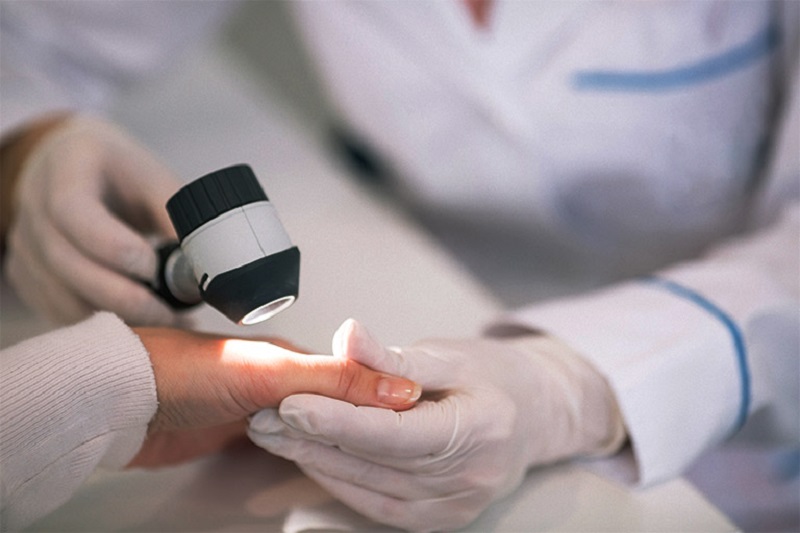 Thăm khám bác sĩ da liễu là cách tốt nhất để biết chính xác lột da tay có ảnh hưởng gì không