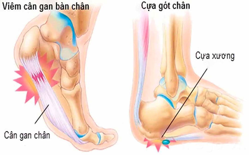 Những nguyên nhân nào có thể gây bệnh?