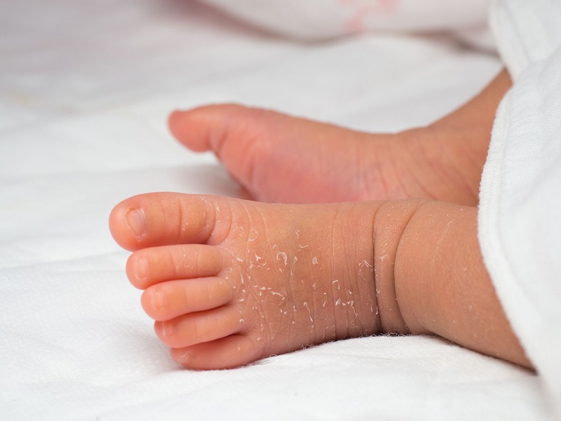 Trẻ sơ sinh khô da có thể là do hiện tượng lột da tự nhiên