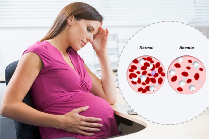 Hàm lượng sắt có trong bắp chuối giúp phòng ngừa chứng thiếu máu do thiếu sắt ở thai phụ