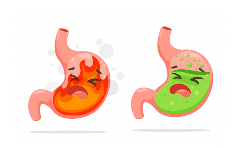 Biểu hiện dễ đoán của bệnh trào ngược dạ dày