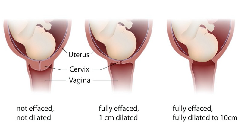 Bầu Bị Đau Sườn Trái: Nguyên Nhân, Triệu Chứng Và Cách Khắc Phục Hiệu Quả