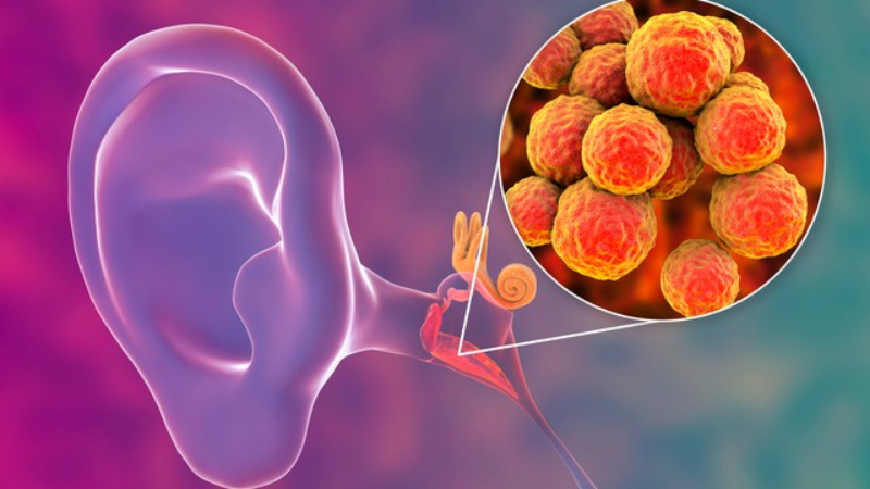 Nhấn vào ảnh để phóng to Viêm tai giữa rất phổ biến và 75% trẻ em bị nhiễm trùng tai ít nhất một lần trước khi bắt đầu đi học