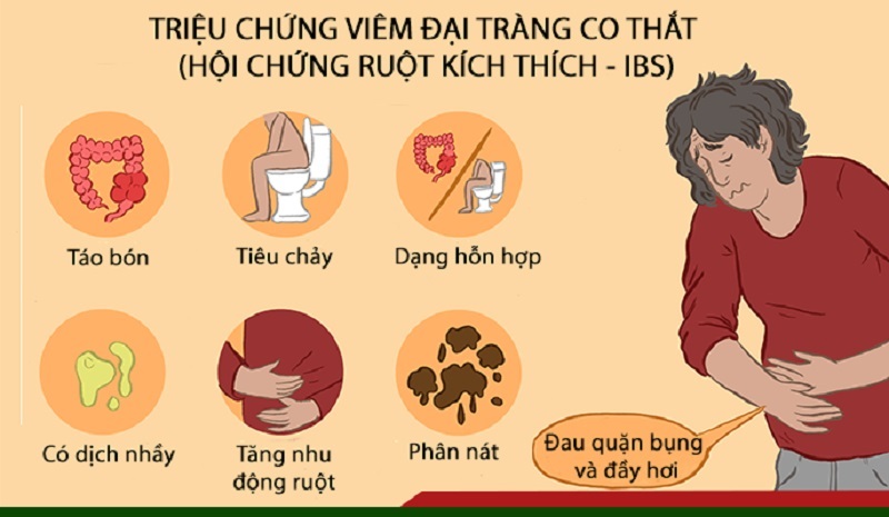 Biểu Hiện Bệnh Đại Tràng Co Thắt