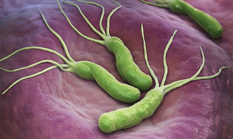 Vi khuẩn Helicobacter pylori là nguyên nhân gây viêm loét dạ dày nghiêm trọng