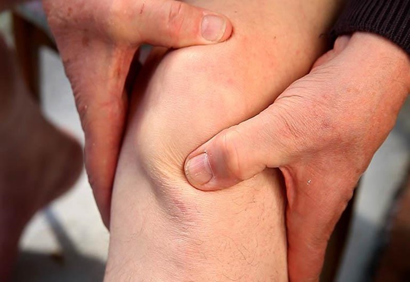 Đau do mắc hội chứng Patellofemoral