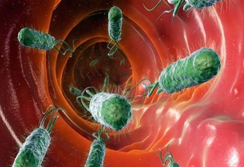 Helicobacter pylori là một trong những tác nhân gây viêm dạ dày