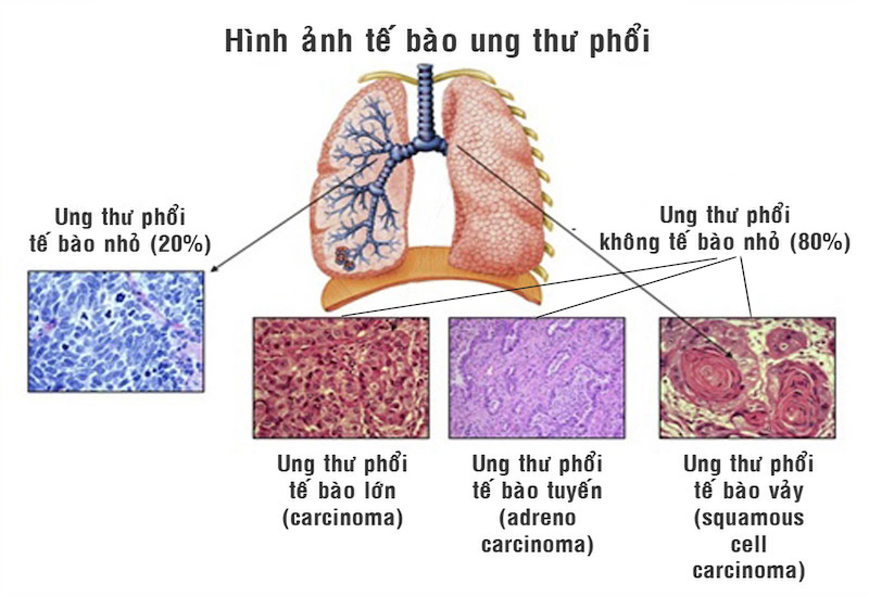 6. Chế độ dinh dưỡng và luyện tập hỗ trợ điều trị