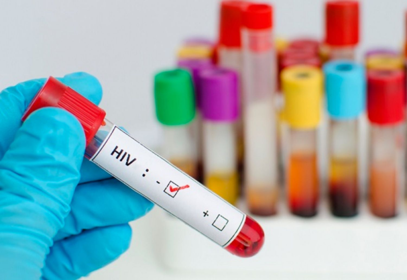 Kết quả xét nghiệm HIV âm tính còn có ý nghĩa là bệnh nhân đang ở giai đoạn “cửa sổ"