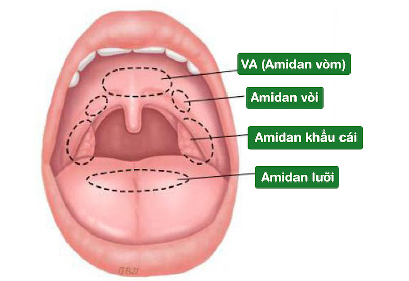 Vị trí của VA