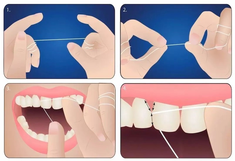 Trước khi đánh răng bạn nên dùng chỉ nha khoa để làm sạch răng