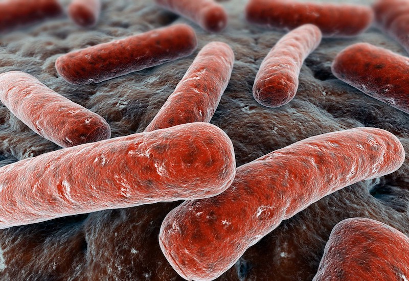 Mycobacterium tuberculosis là vi khuẩn gây lao phổi