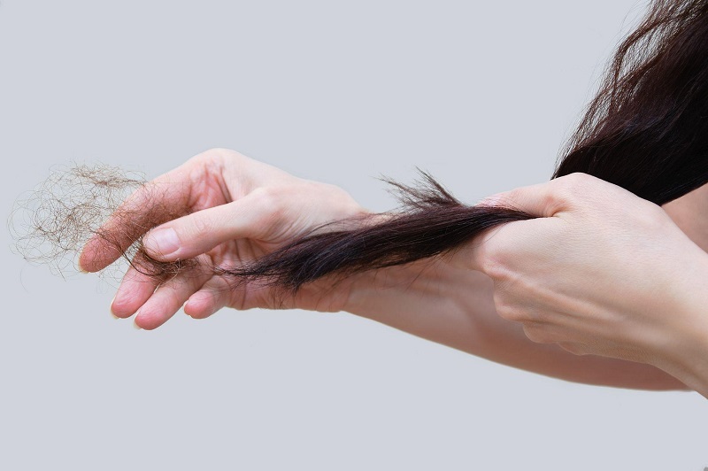 Bạn có thể nhận biết sự thiếu hụt kẽm trong cơ thể qua tình trạng rụng tóc