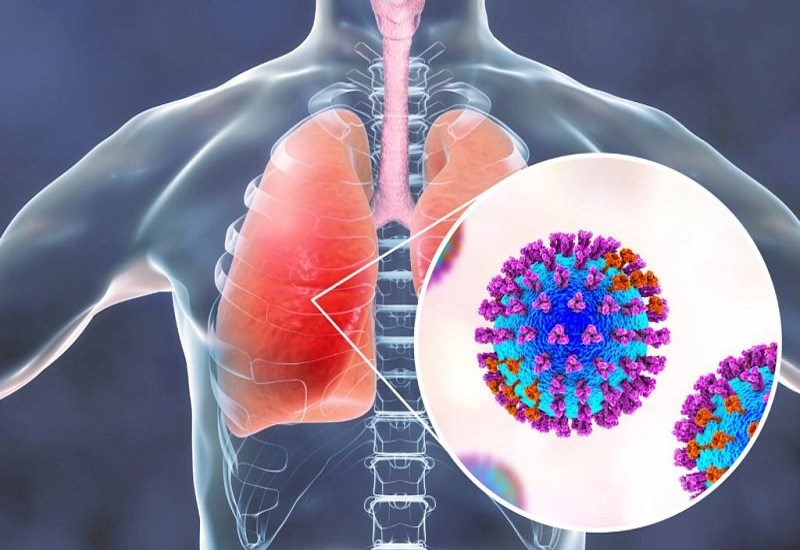 Virus hợp bào hô hấp (gọi tắt là virus RSV) là tác nhân gây bệnh đường hô hấp