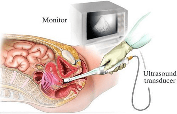 4 tuần đi siêu âm được chưa