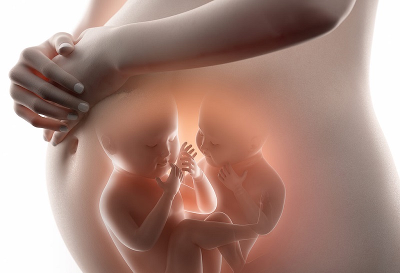 Đa thai có thể khiến cho nguy cơ dị tật cao hơn