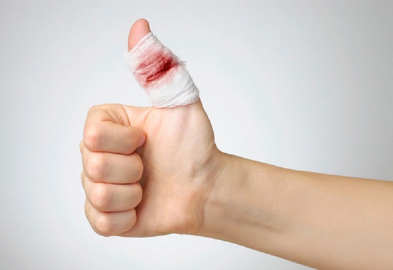 Tiểu cầu có vai trò quan trọng trong quá trình cầm máu khi bị đứt tay