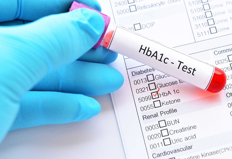 Xét nghiệm HbA1C