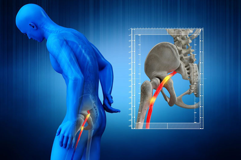 Chườm nóng hỗ trợ giảm đau hiệu quả