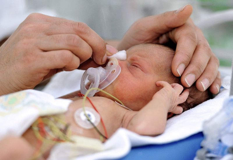 Trẻ sinh ra với bào thai suy dinh dưỡng thường có sức khỏe rất kém