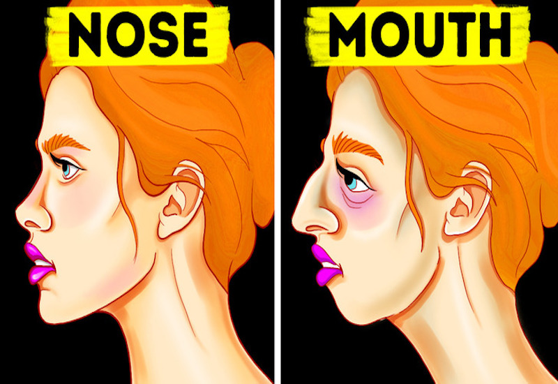 Thở bằng miệng trong thời gian dài có thể làm thay đổi cấu trúc khuôn mặt