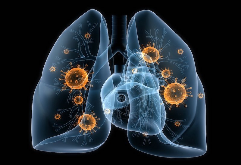 Hãy chú ý đến các dấu hiệu cho thấy phổi đang gặp vấn đề để kịp thời điều trị