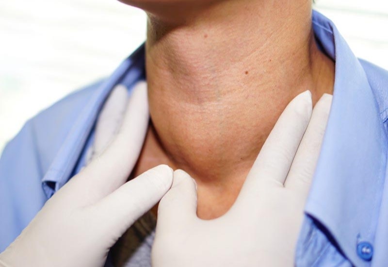 Người mắc bệnh bướu cổ có thể được chỉ định chụp xạ hình tuyến giáp