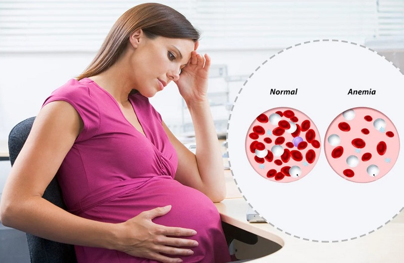 Phụ nữ mang thai có nguy cơ cao thiếu sắt do nhu cầu cơ thể tăng cao