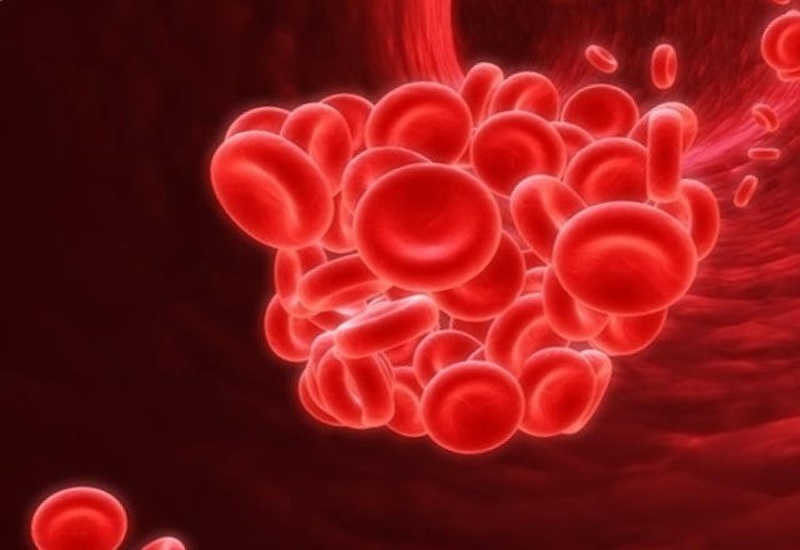 Hội chứng kháng phospholipid tăng nguy cơ hình thành những cục máu đông
