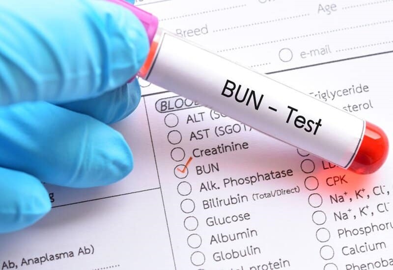 Xét nghiệm BUN cung cấp thông tin về hàm lượng nitơ có trong ure