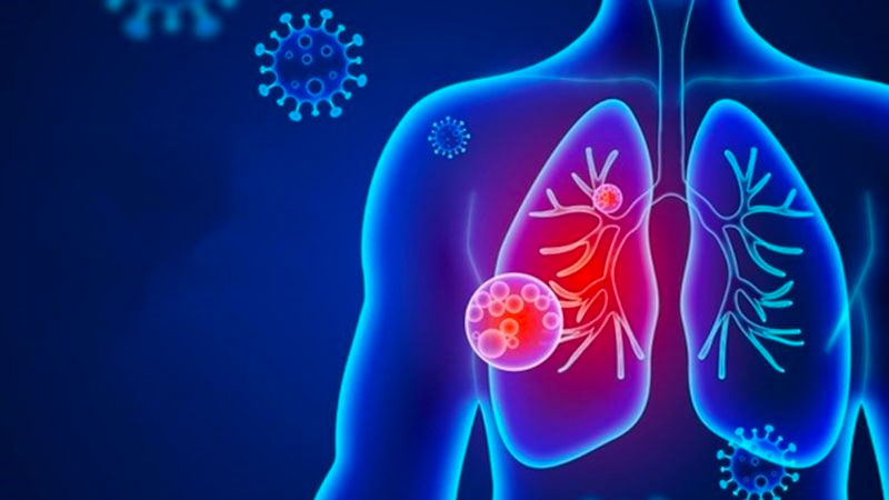 Suy hô hấp do các bệnh về phổi
