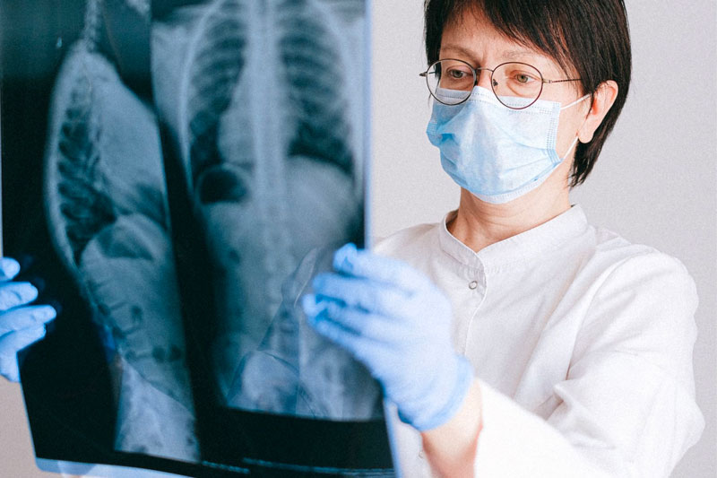 Dựa vào Xquang có thể phát hiện và đánh giá bệnh viêm phổi thùy