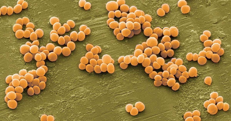 Staphylococcus aureus gây lẹo mắt nên lẹo mắt có lây không câu trả lời là có lây khi có hành động tiếp xúc với vi khuẩn